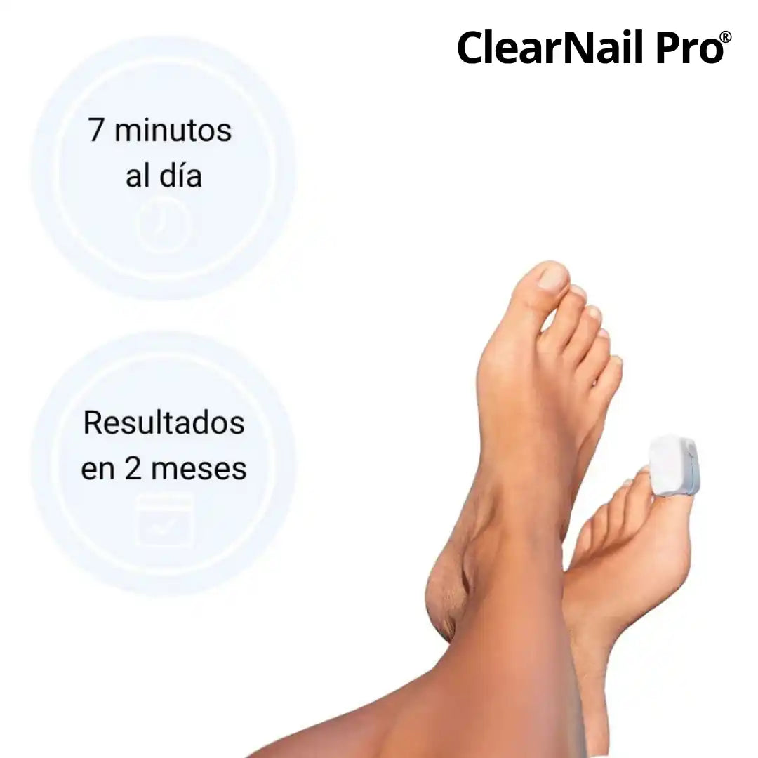 ClearNail Pro® Dispositivo láser para tratamiento de hongos en las uñas OFFER