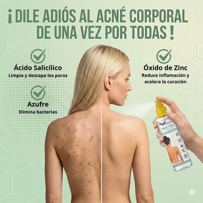 Afrodita Back Acne Spray
